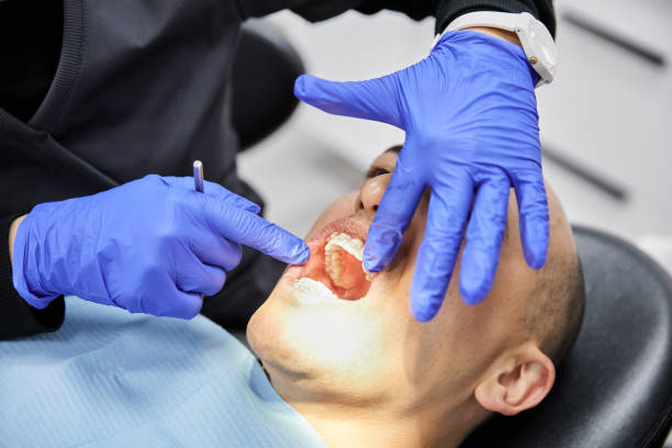 Best Knocked-Out Tooth (Avulsed Tooth) Treatment in Wellington, TX